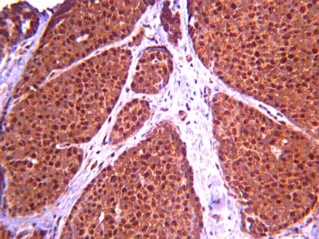 Anti-ASPM Antibody