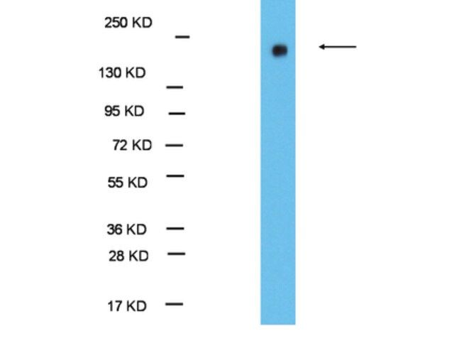 Anti-EHMT1/GLP1 Antibody