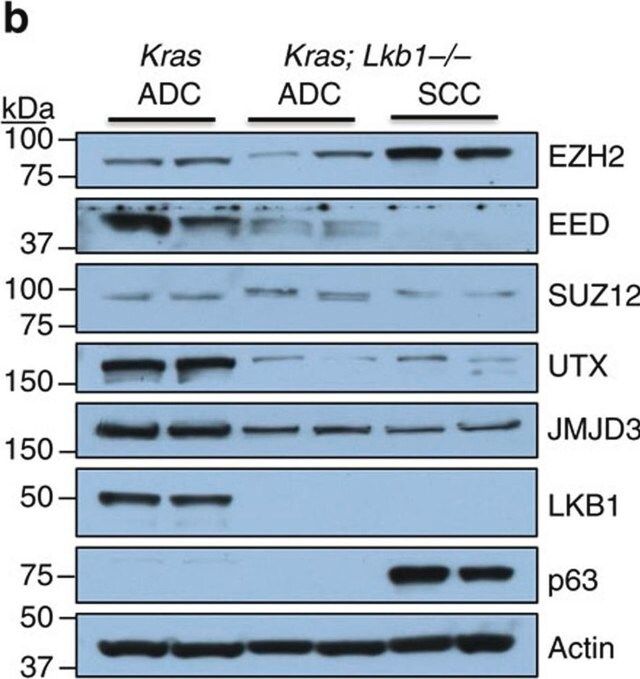 Anti-EED Antibody