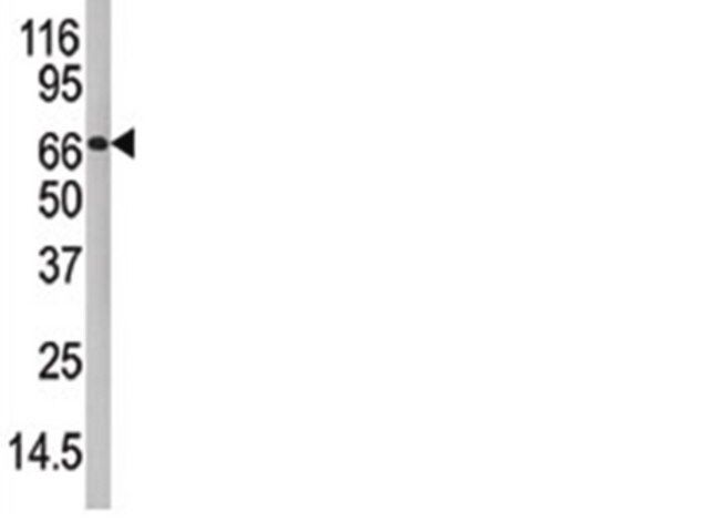 Anti-PADI4 Antibody, CT