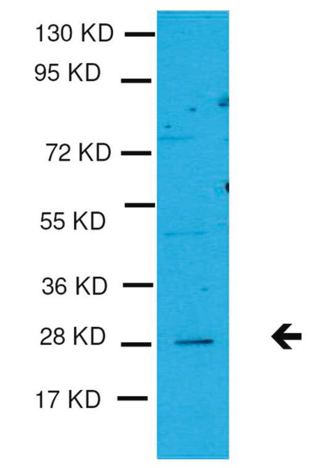 Anti-TGIF2 Antibody