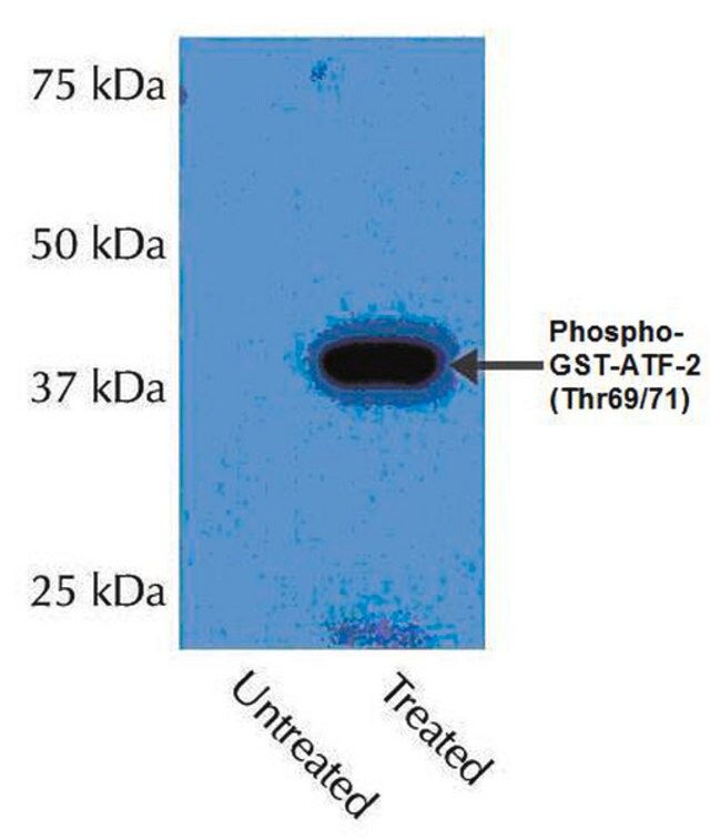 Anti-phospho-p38 (Thr180/Tyr182) Antibody