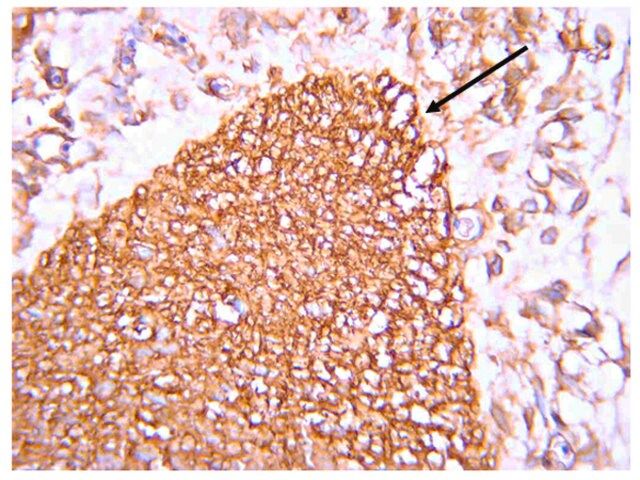 Anti-Wnt3a Antibody