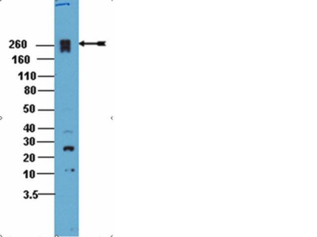 Anti-PEAK1 Antibody