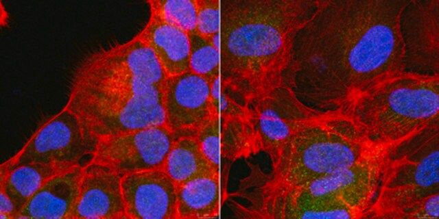 Anti-Rac1b Antibody