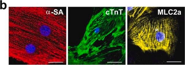 Anti--Actinin (Sarcomeric) antibody, Mouse monoclonal