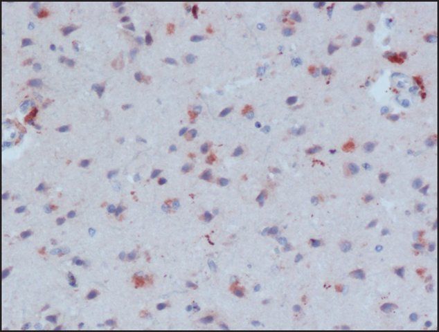 Anti--Amyloid antibody, Mouse monoclonal antibody produced in mouse