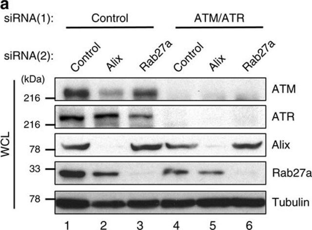 Anti-ATM antibody,Mouse monoclonal