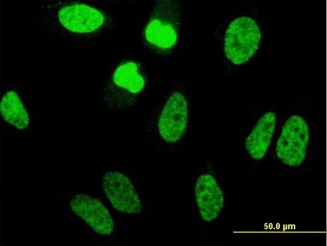 Monoclonal Anti-TAF11 antibody produced in mouse