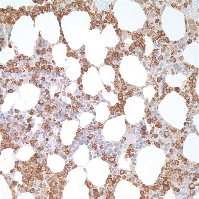 Myeloperoxidase Rabbit Polyclonal Antibody