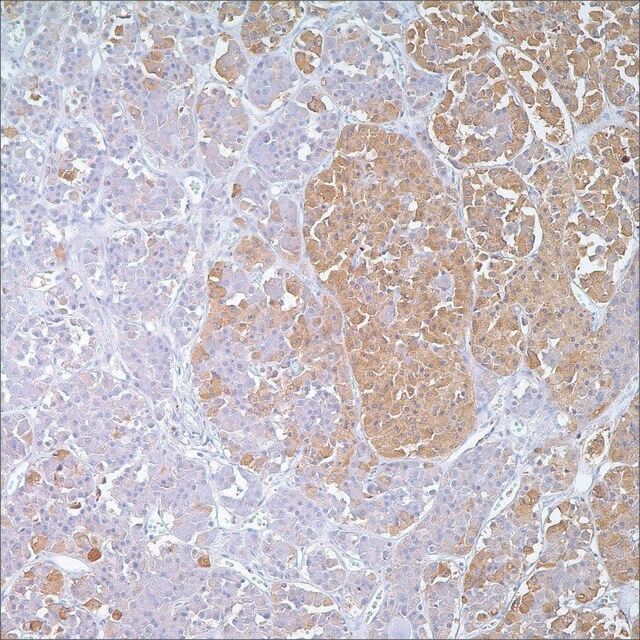 ACTH Rabbit Polyclonal Antibody