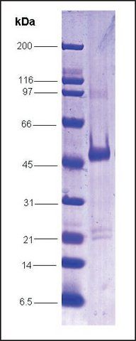 Pregnane X Receptor human