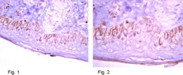 Anti-Harmartin (TSC1) Antibody