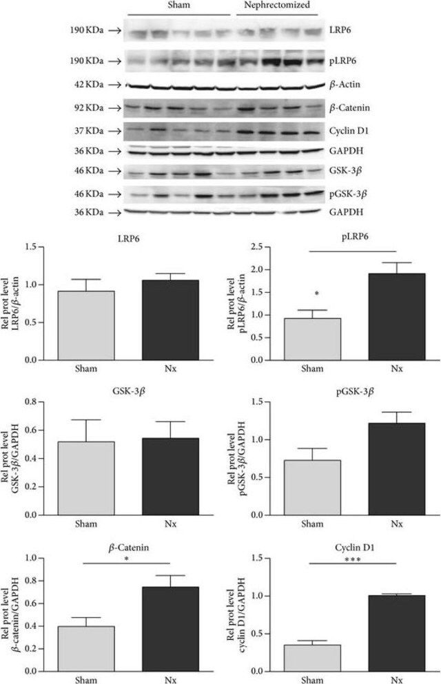 Monoclonal Anti-Cyclin D1 antibody produced in mouse