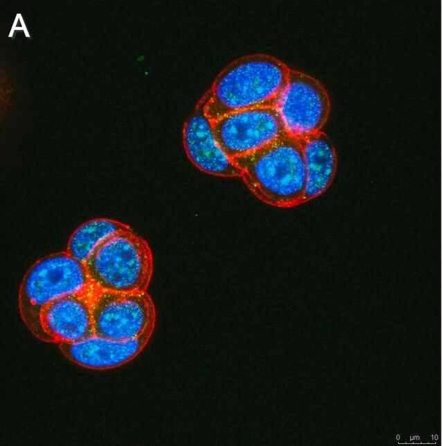 Anti-Ubiquilin 4 Antibody, clone 5K6 ZooMAb<sup>®</sup> Rabbit Monoclonal