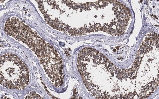 Anti-TSTA3 Antibody, clone 2N10-H1 ZooMAb<sup>®</sup> Rabbit Monoclonal