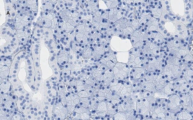 Anti-TMEM16A Antibody, clone 3J18, ZooMAb<sup>®</sup> Rabbit Monoclonal