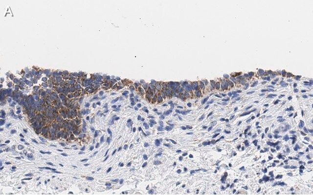 Anti-TMEM261 Antibody, clone 2C22 ZooMAb<sup>®</sup> Rabbit Monoclonal