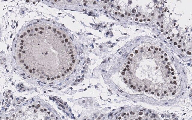 Anti-UBR5 Antibody, clone 2F14 ZooMAb<sup>®</sup> Rabbit Monoclonal