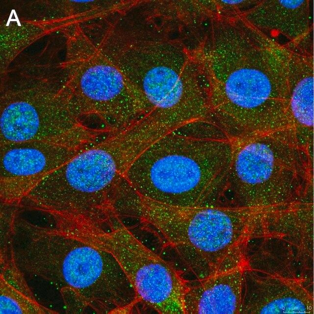 Anti-Treslin Antibody, clone 5L19 ZooMAb<sup>®</sup> Rabbit Monoclonal