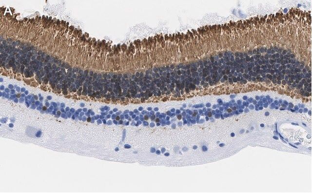 Anti-Recoverin Antibody, clone 1K10 ZooMAb<sup>®</sup> Rabbit Monoclonal