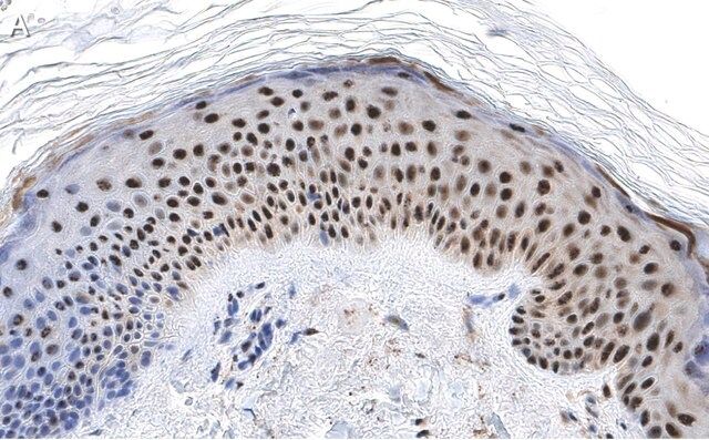 Anti-RXR-alpha Antibody, clone 2I8 ZooMAb<sup>®</sup> Rabbit Monoclonal