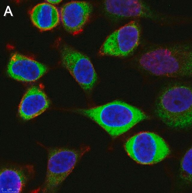 Anti-CAPRIN1 Antibody, clone 1F2 ZooMAb<sup>®</sup> Rabbit Monoclonal