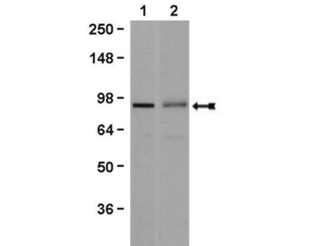 Anti-Beta Catenin Antibody, clone 7F7.2