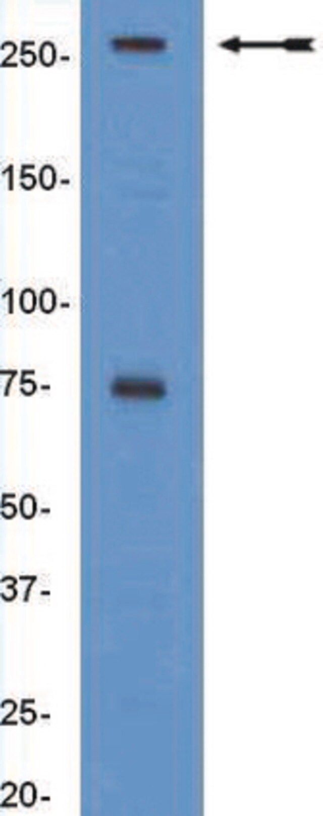 Anti-BAF250a/ARID1a Antibody, clone PSG3