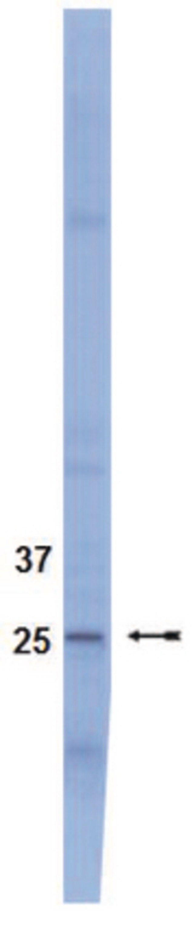 Anti-SOCS3 Antibody, clone 1B2