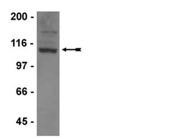 Anti-GluR1 Antibody, clone C3T, rabbit monoclonal