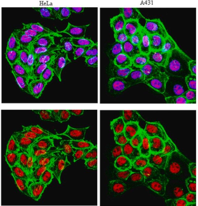 Anti-RAR Antibody, clone 9-9A6