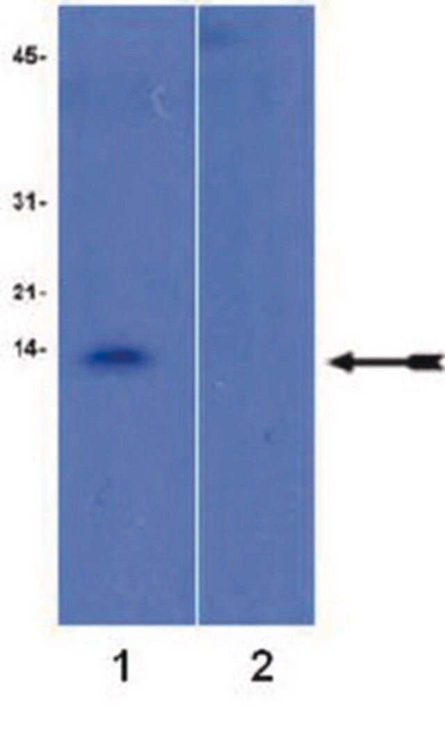 Anti-trimethyl-Histone H4 (Lys20), Antibody, rabbit monoclonal