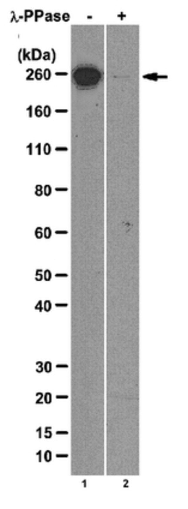 Anti-RNA polymerase II subunit B1 (phospho-CTD Ser-7) Antibody, clone 4E12