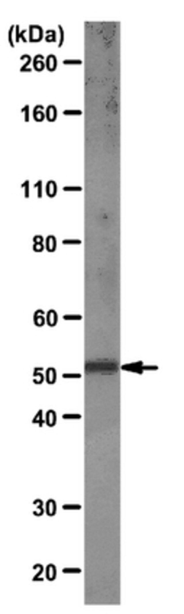 Anti-Retinoid-Related Orphan Receptor  T Antibody, clone RORg2