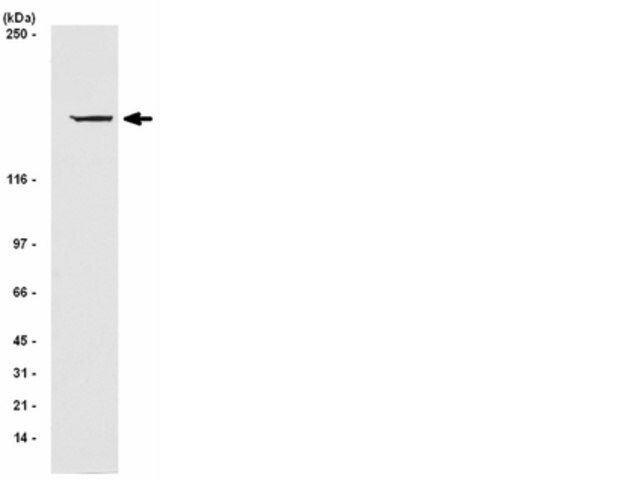 Anti-IRS1 Antibody, clone AW58, rabbit monoclonal