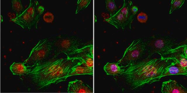 Anti-TLS Antibody, clone 1FU-1D2