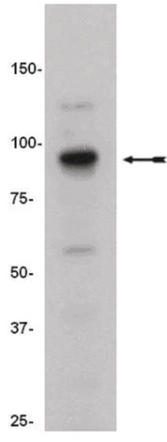 Anti-SUZ12 Antibody, clone 3C1.2