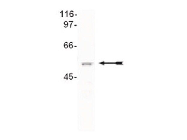 Anti-CUGBP2 Antibody, clone 1H2