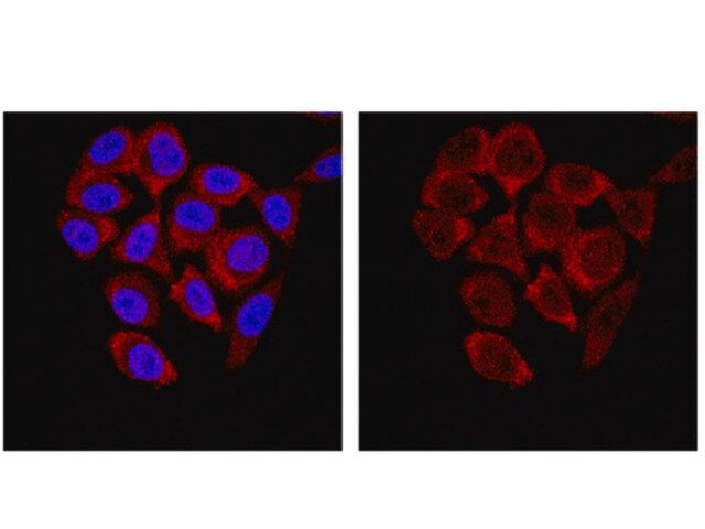 Anti-SMN Antibody, clone 62E7