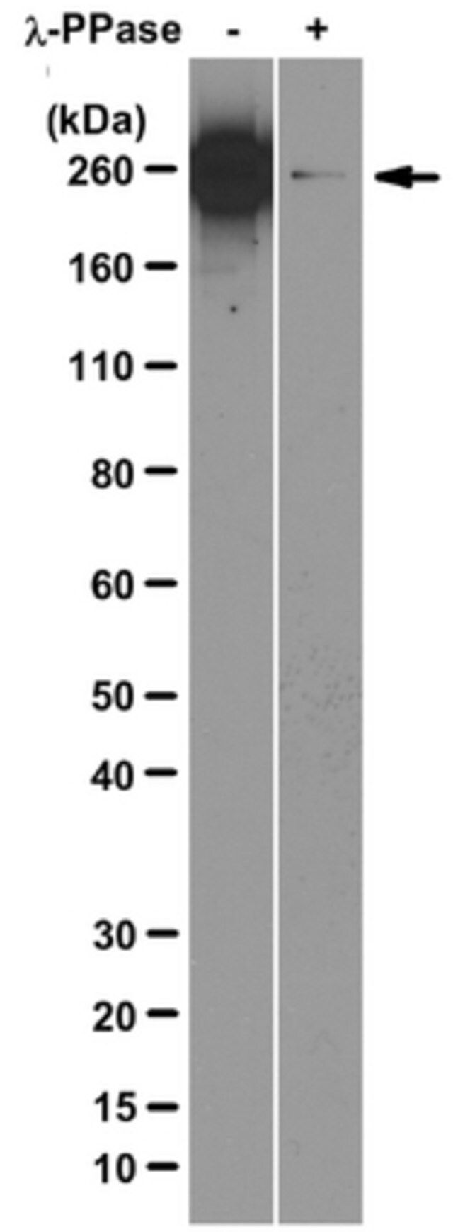 Anti-RNA polymerase II subunit B1 (phospho CTD Ser-2) Antibody, clone 3E10