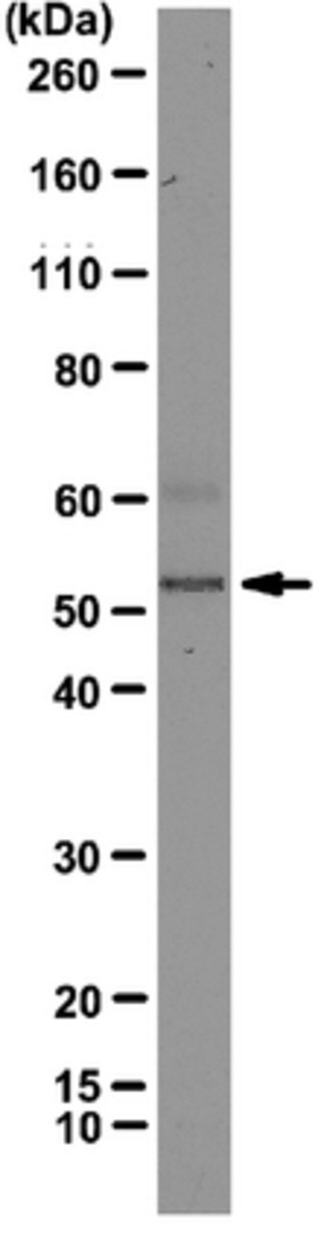 Anti-hnRNP F Antibody, clone 3H4