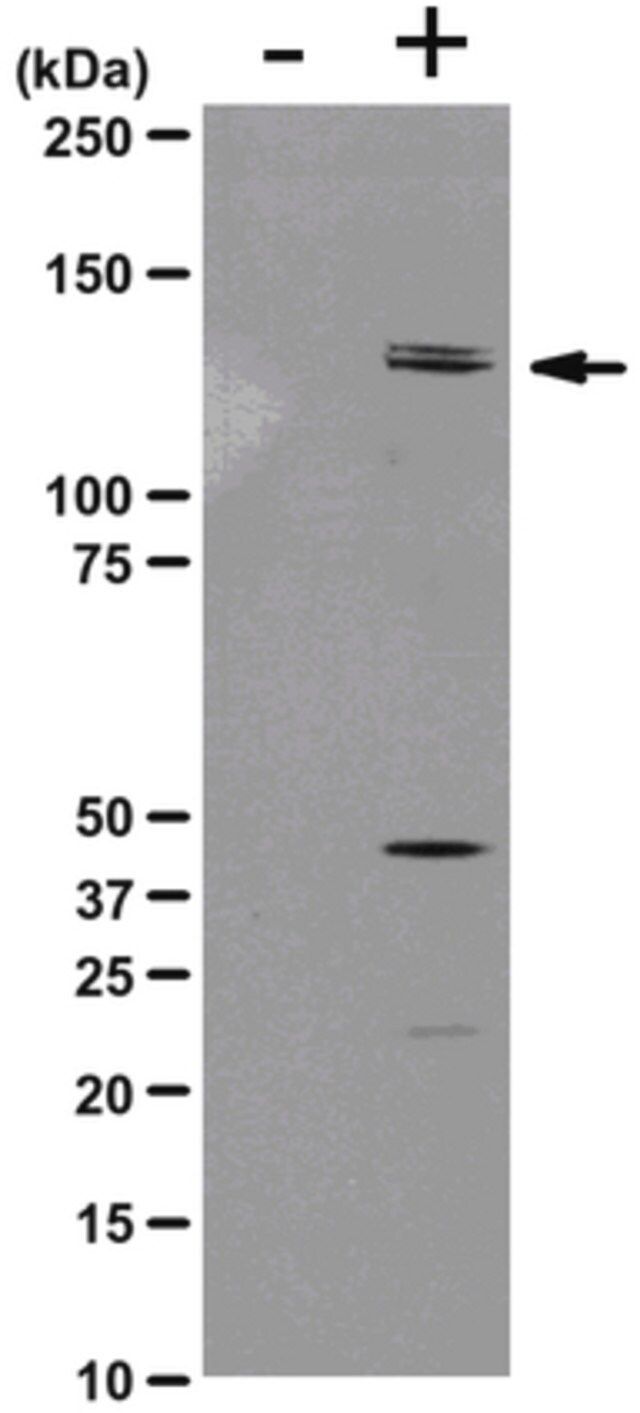 Anti-phospho-MYPT1 (Thr850) Antibody,, rabbit monoclonal