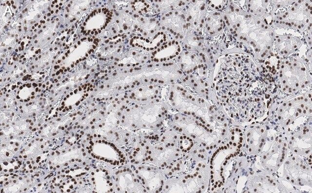 Anti-53BP1 Antibody, clone 1H16 ZooMAb<sup>®</sup> Rabbit Monoclonal