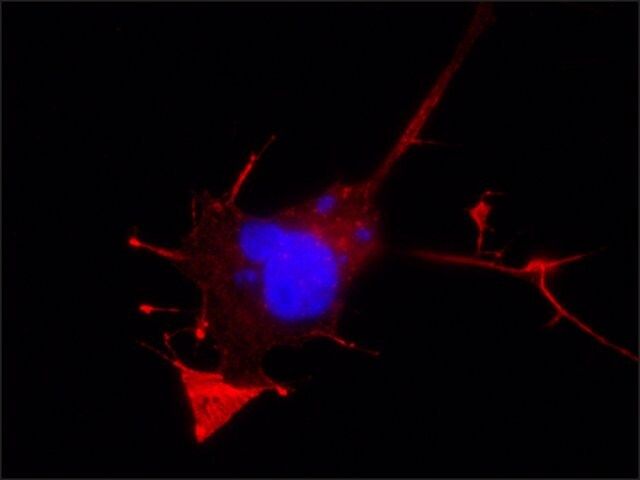 Anti-E6AP antibody, Mouse monoclonal