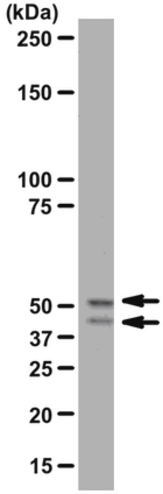 Anti-GSK3/ Antibody, rabbit monoclonal