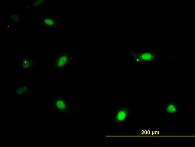 Monoclonal Anti-IRX3 antibody produced in mouse