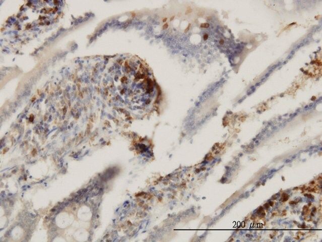 Monoclonal Anti-ENTPD6 antibody produced in mouse