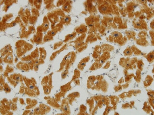 Monoclonal Anti-MFN2 antibody produced in mouse