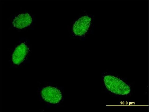 Monoclonal Anti-GCM1 antibody produced in mouse